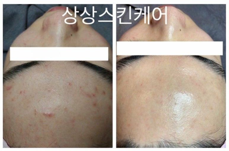 상상스킨케어 이미지