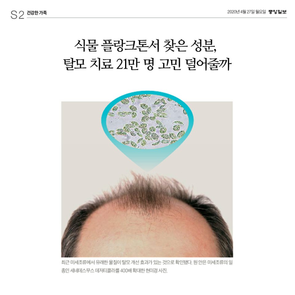 찬스인셀덤 이미지
