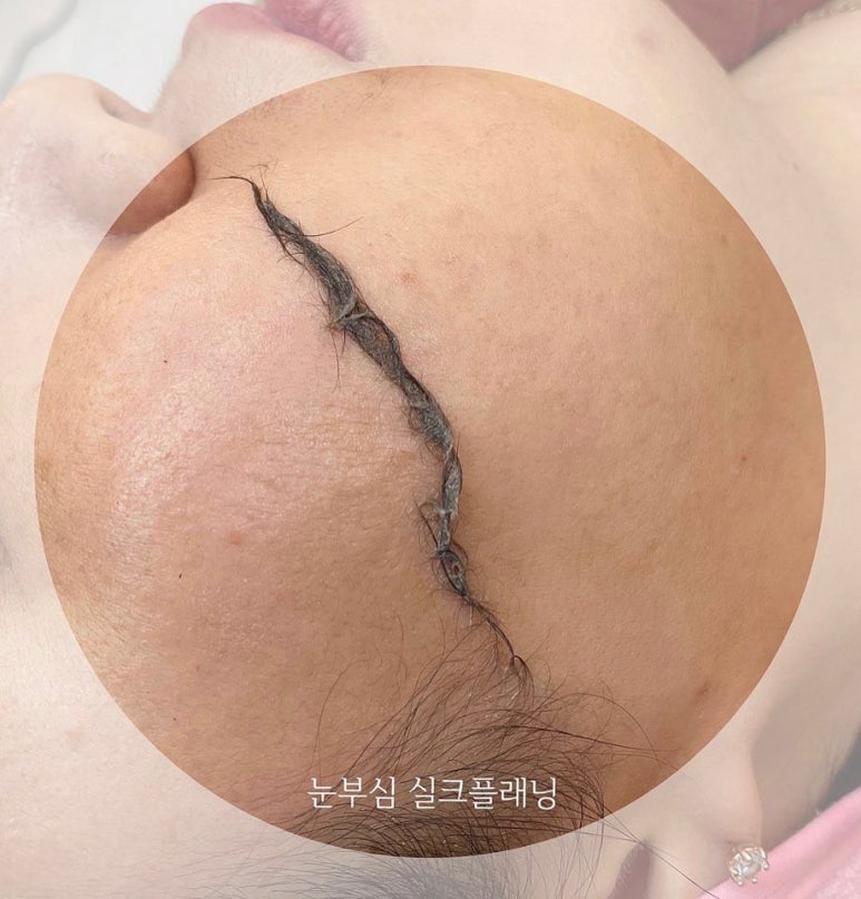 노블리즈 이미지