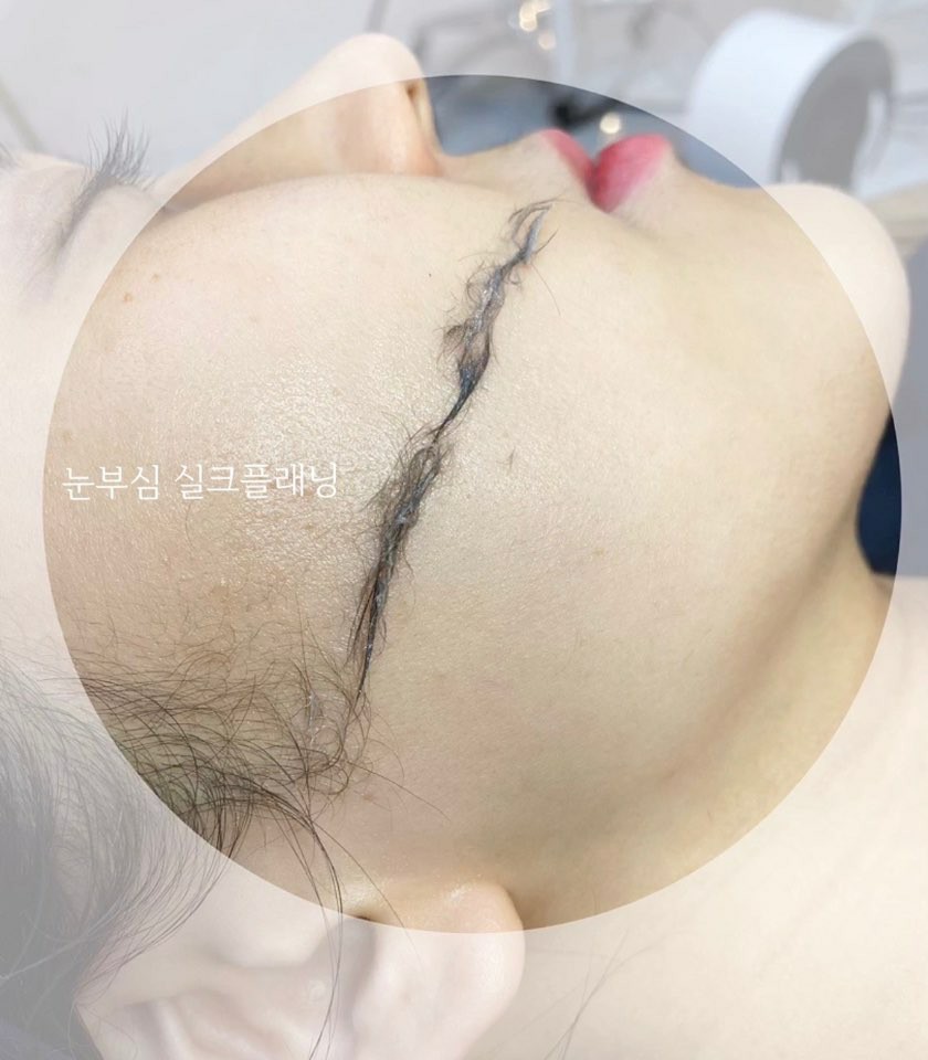 노블리즈 이미지