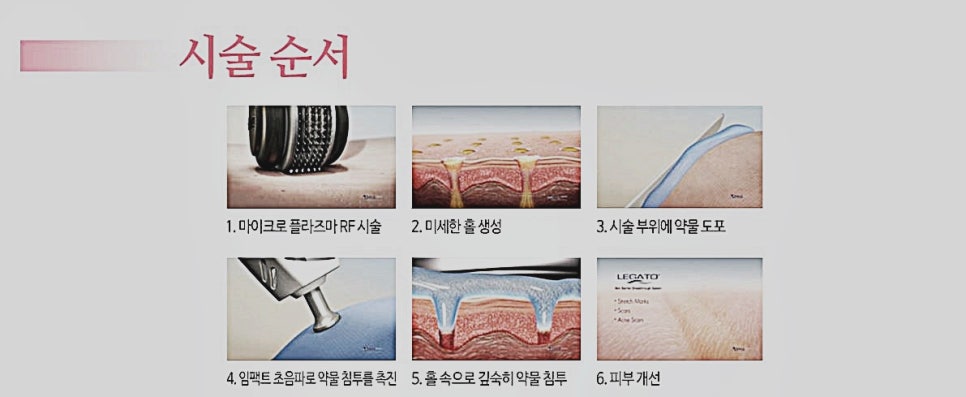 레가토 이미지
