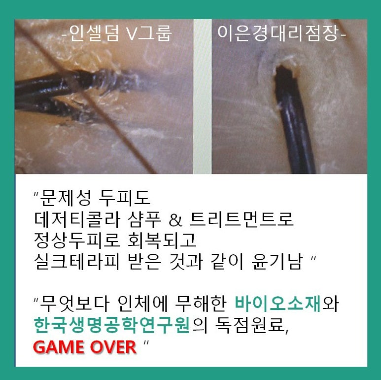 인셀덤 뷰티라인 이미지