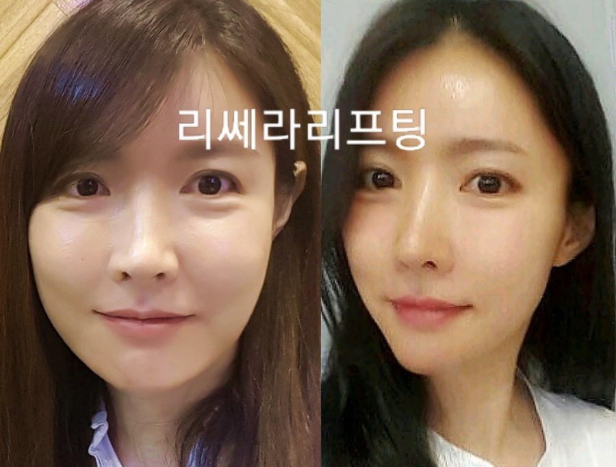 오직얼굴연구소 이미지