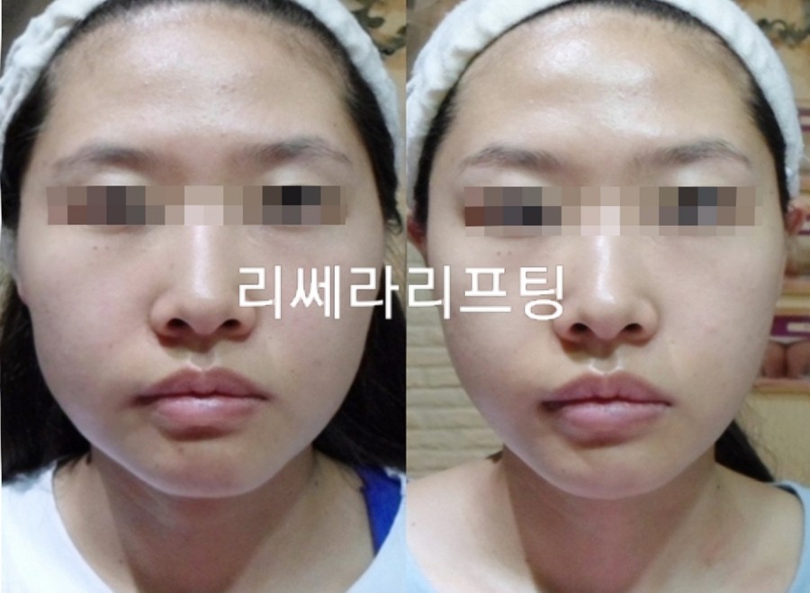 오직얼굴연구소 이미지
