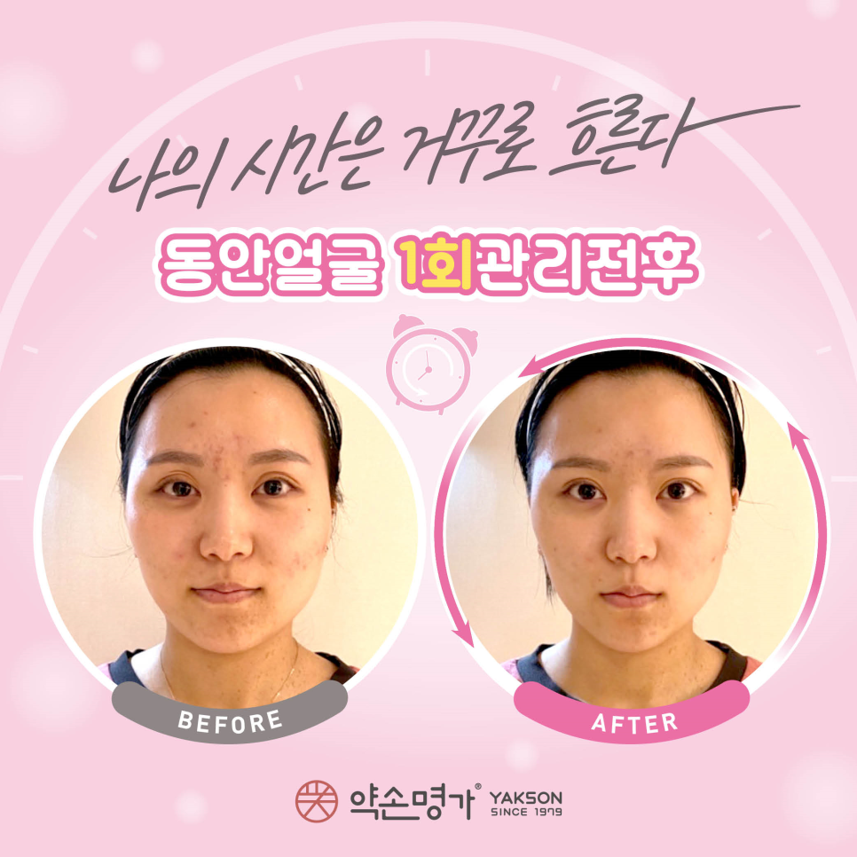 약손관리 이미지