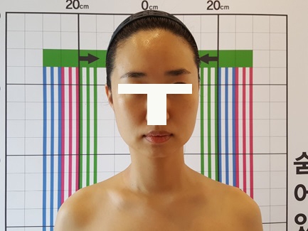 경락관리 이미지