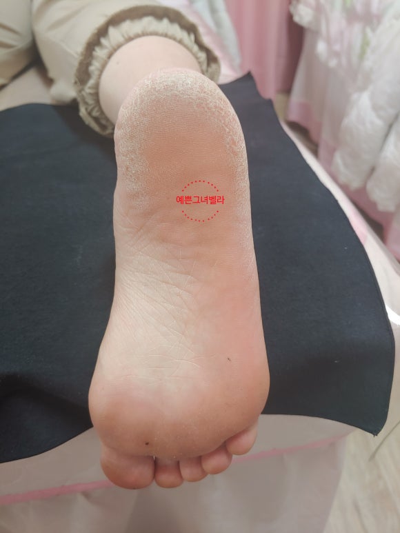 벨라발관리 이미지