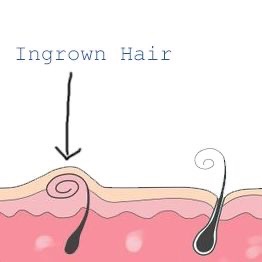 인헤어(in-hair) 이미지