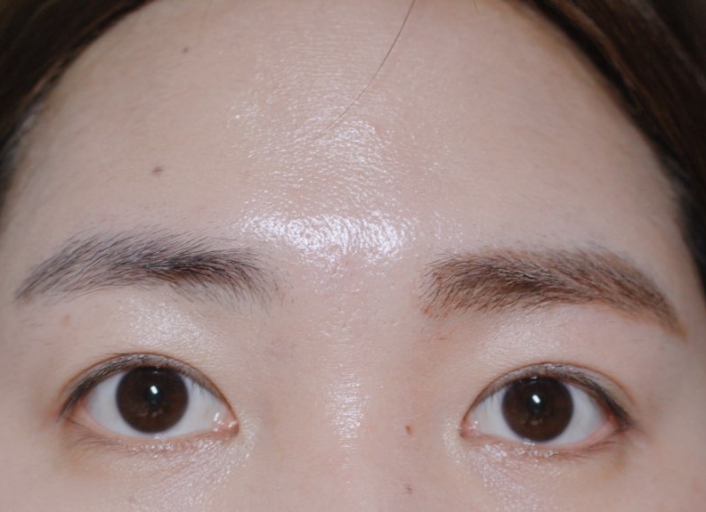 오렌지브로우 이미지