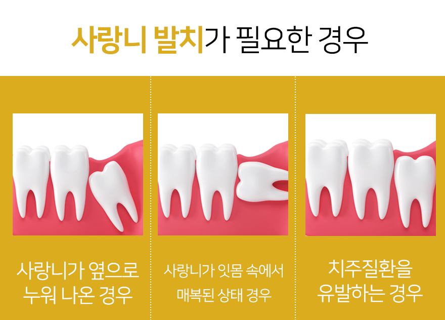 서울턱사랑니치과 이미지