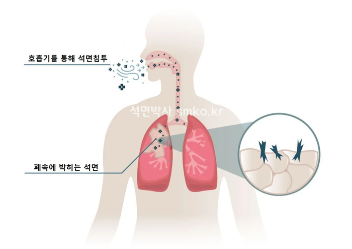 베스토스 이미지