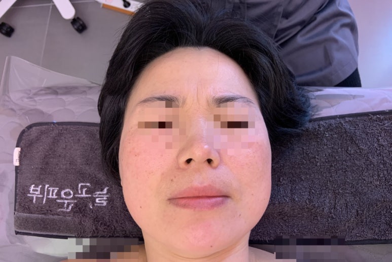늘,고운피부 이미지