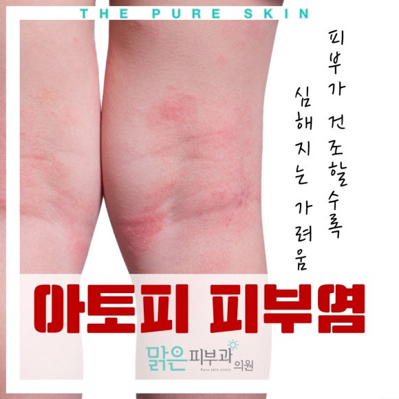 맑은피부과 이미지