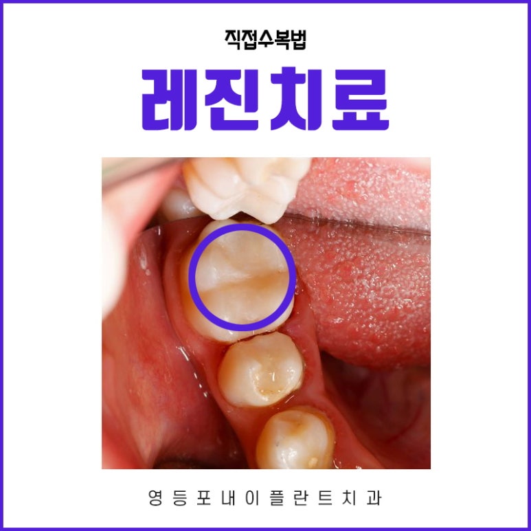 내이치과 이미지