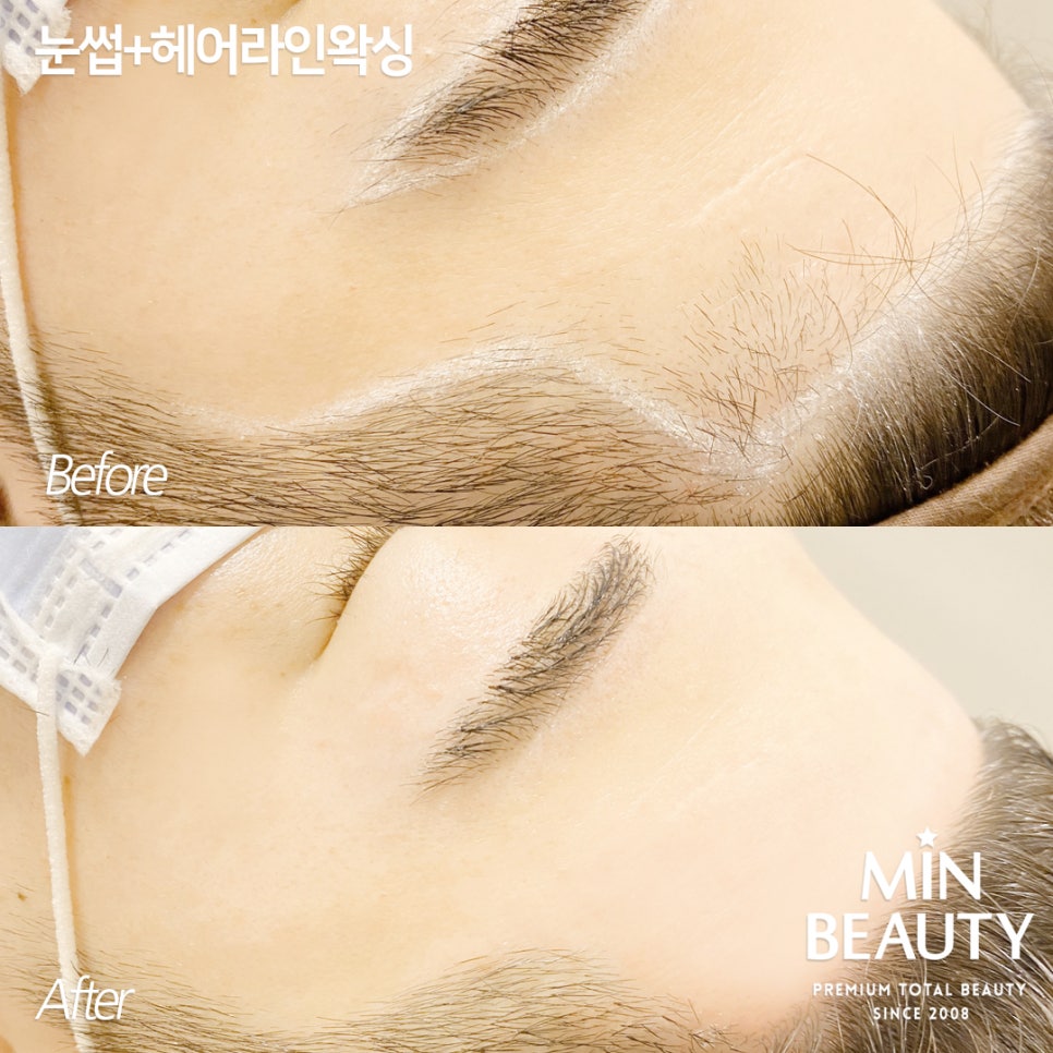 뷰티라인샵 이미지