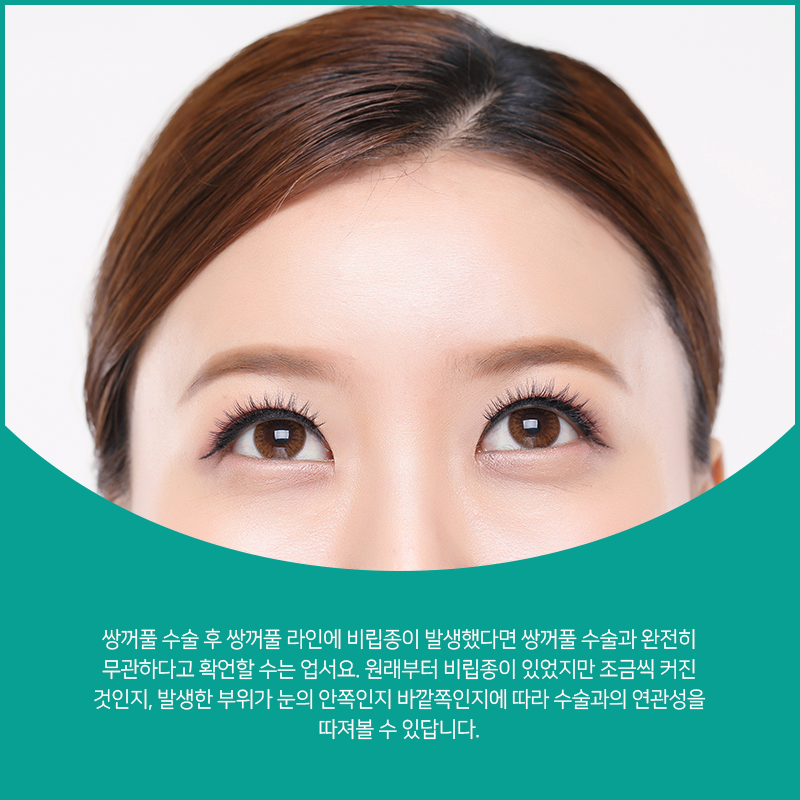 신세계성형외과의원 이미지