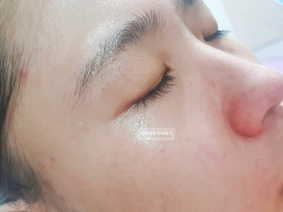 와이앤피 이미지