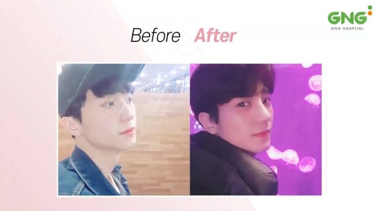 지앤지코 이미지