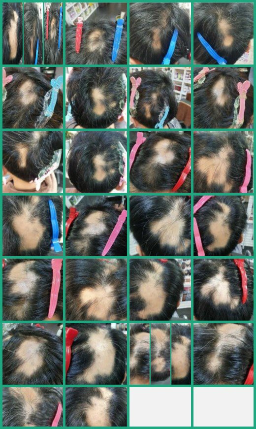 염색팡팡 이미지