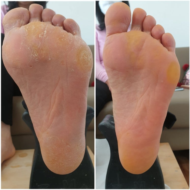 로제네일 이미지
