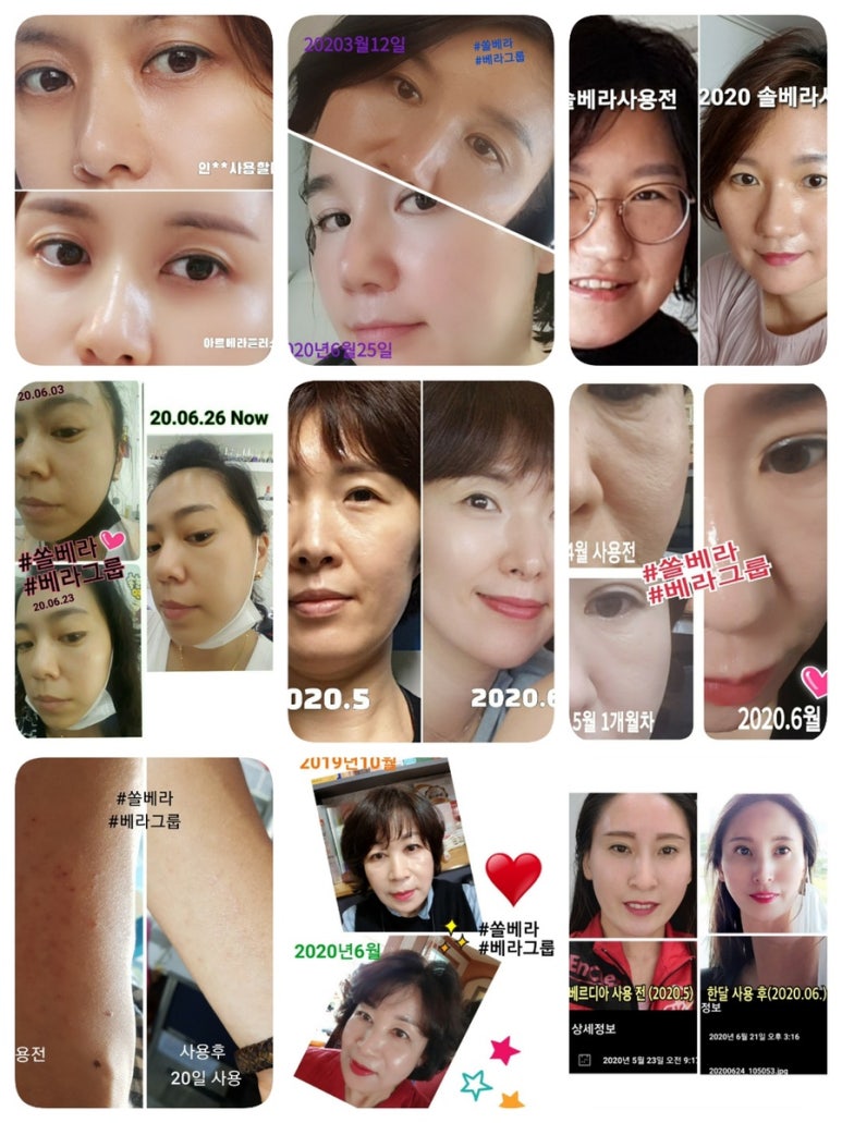 쏠베라 이미지