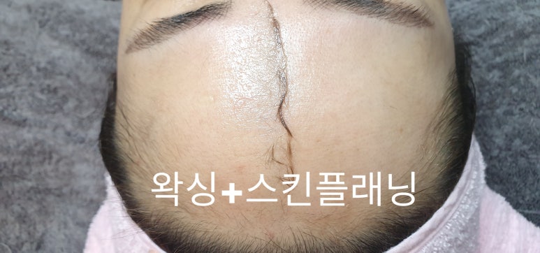 미네일앤스킨 이미지