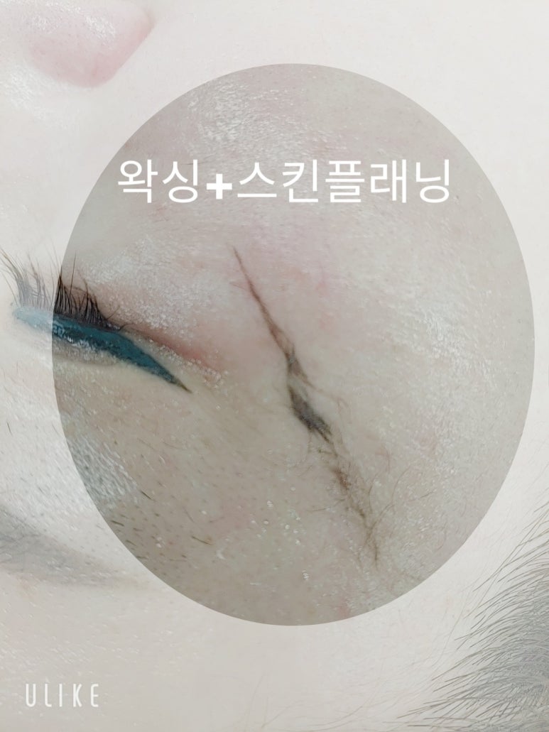 미네일앤스킨 이미지