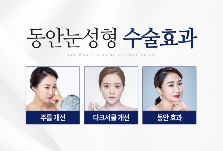 이원제성형외과 이미지