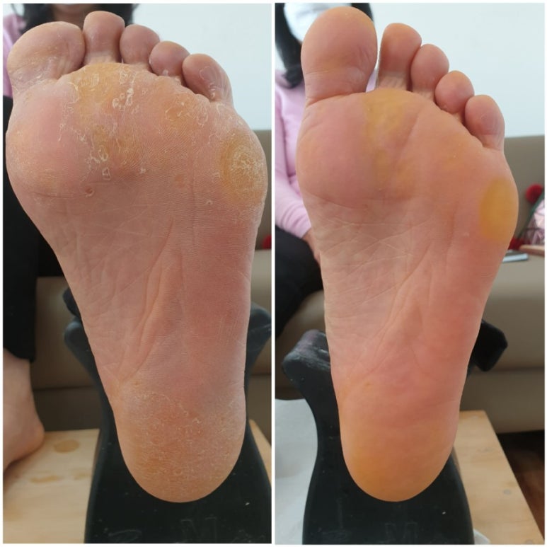 네일매끈 이미지