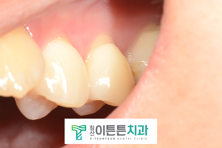 침산이튼튼치과 이미지