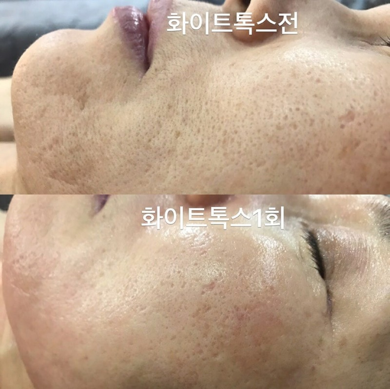 샤인피부관리실 이미지