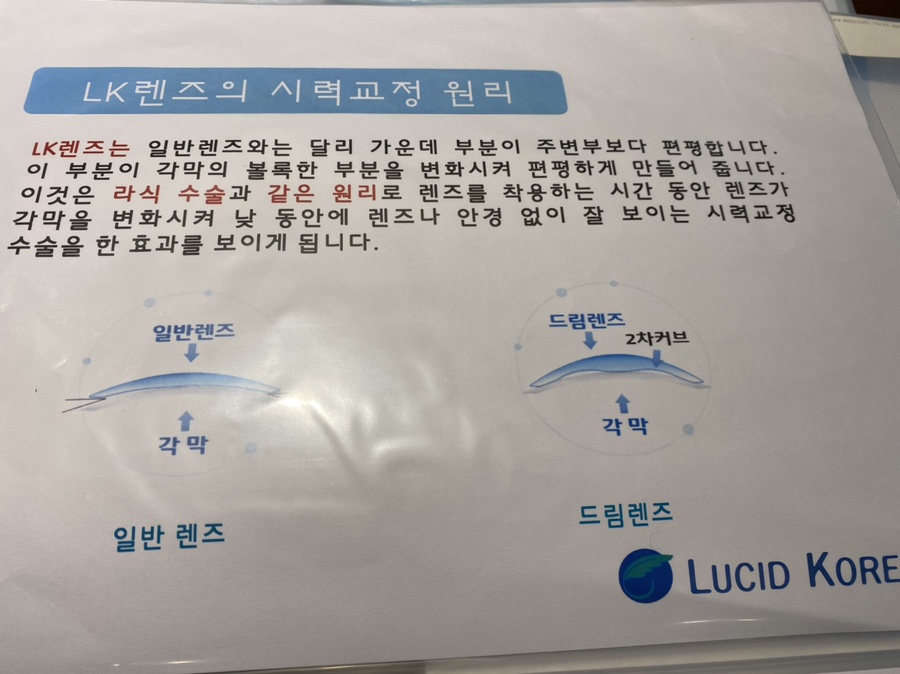 예스안과 이미지
