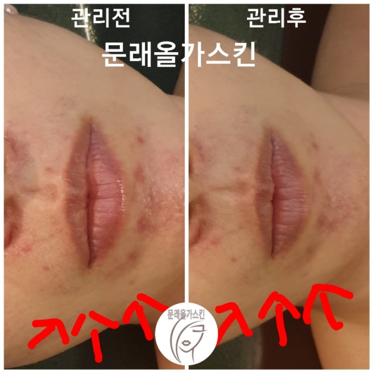 올가스킨 이미지