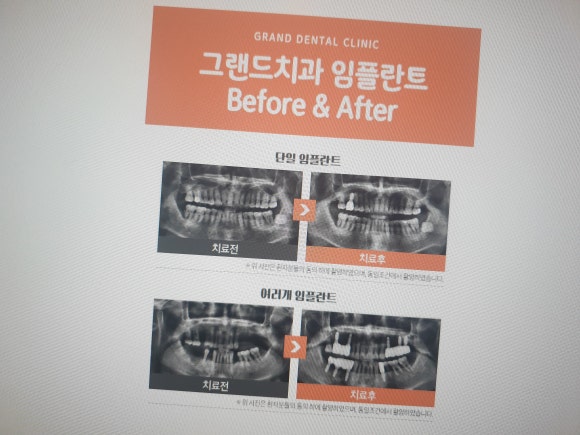 그랜드치과의원 이미지