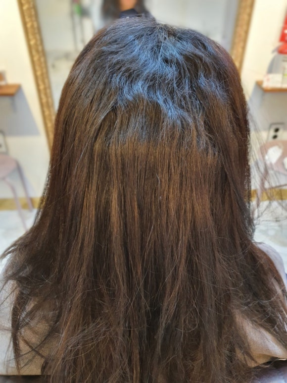 미라클헤어 이미지