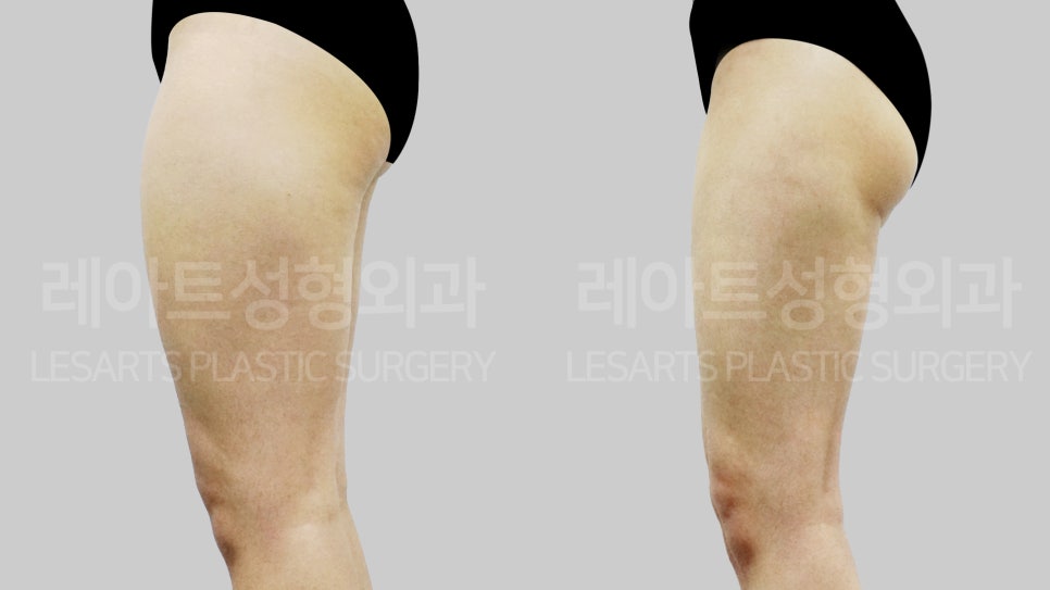 아트라인성형외과의원 이미지
