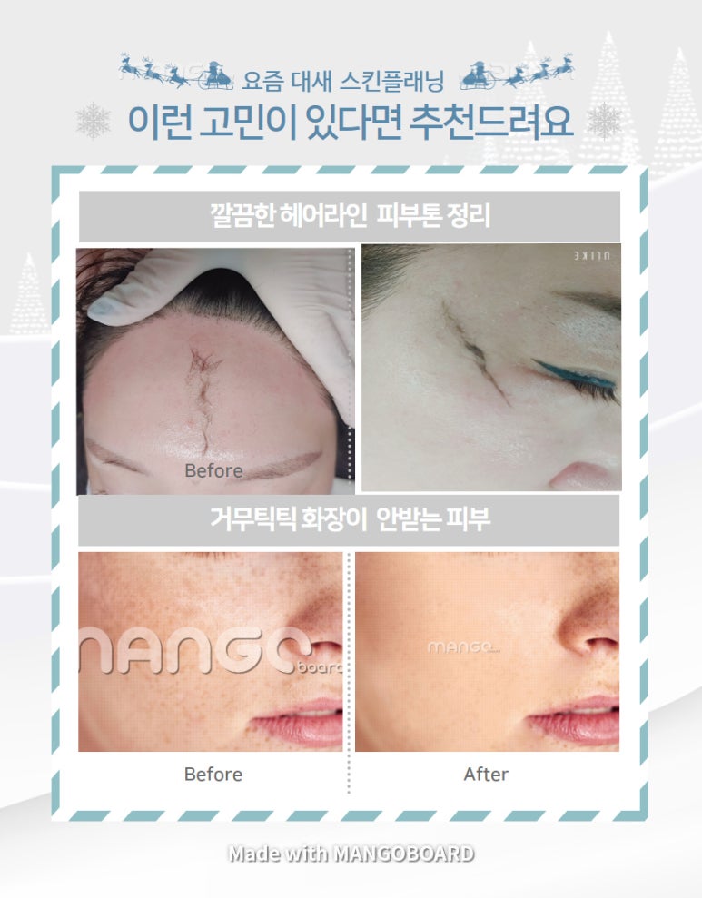 미네일앤스킨 이미지