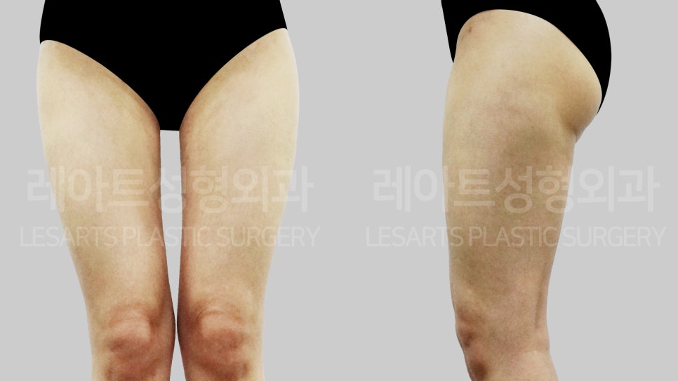 아트라인성형외과의원 이미지