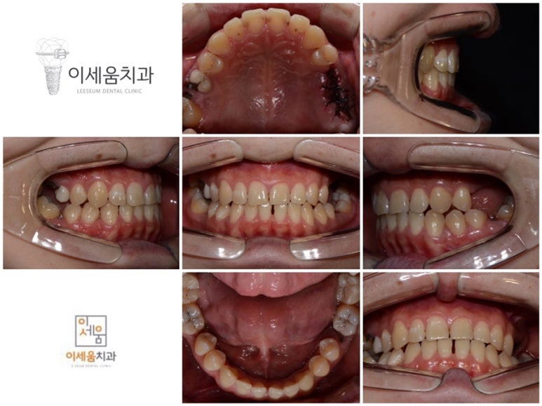 이세움치과 이미지