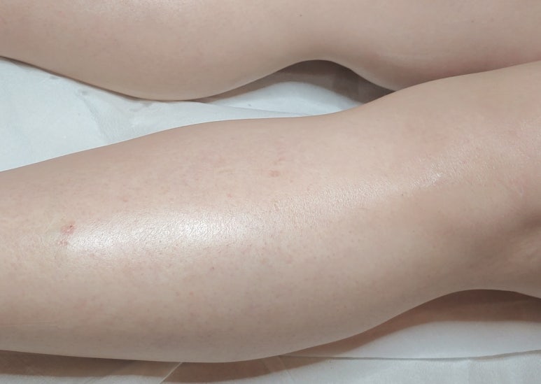 보떼샤인 이미지