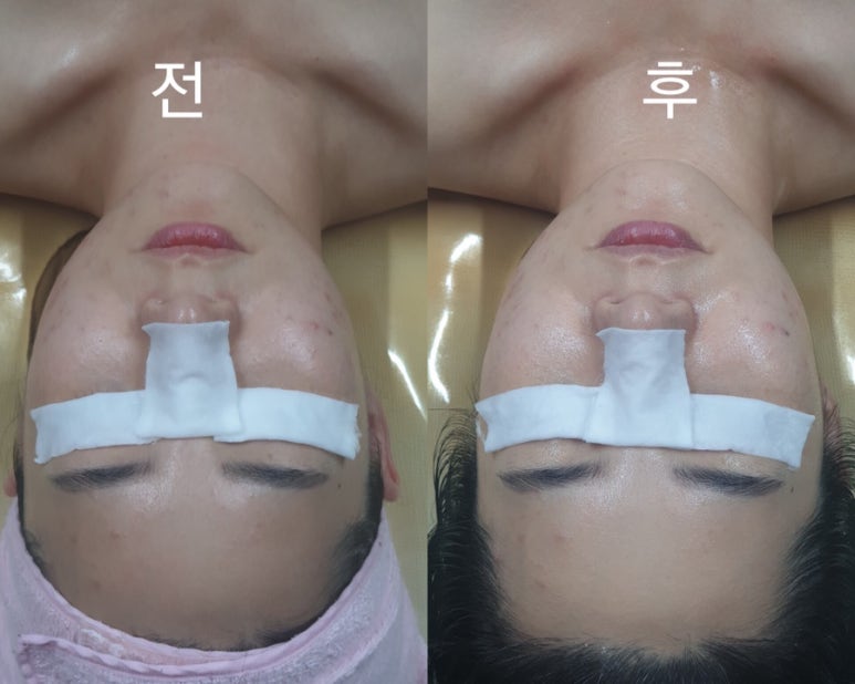 뷰티스킨케어 이미지