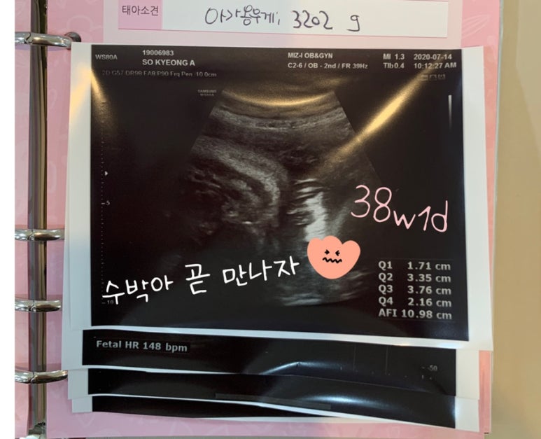 라이크분식 이미지