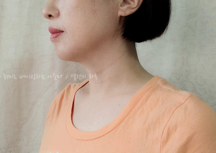 와이앤피 이미지