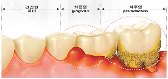 침산이튼튼치과 이미지