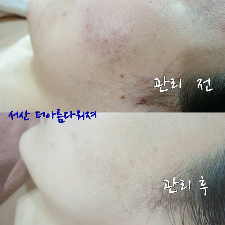 더아름다워져 이미지