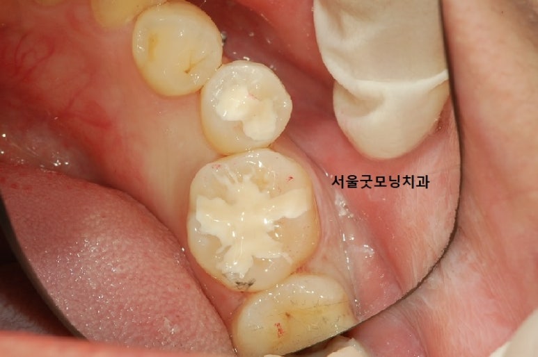 서울굿모닝치과 이미지