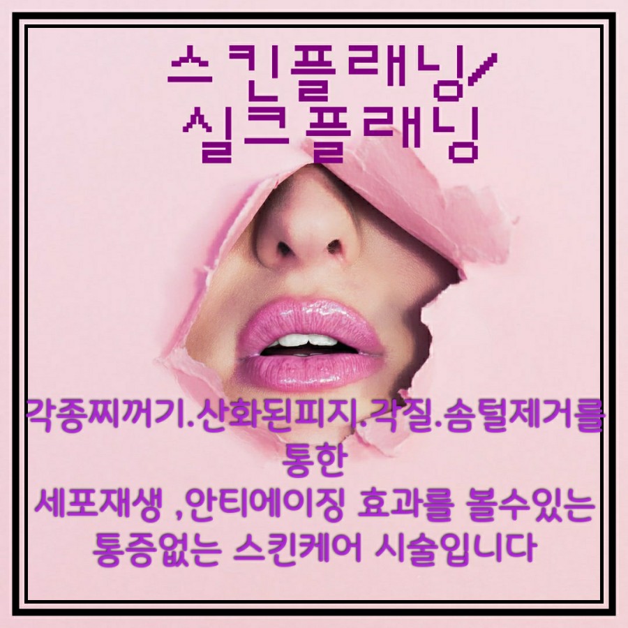 벨로왁싱 이미지