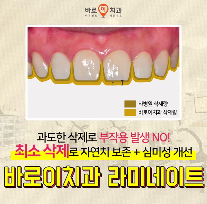 바로이치과 이미지