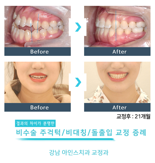 아인스치과의원 이미지