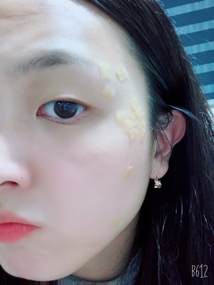 크리스탈피부과의원 이미지
